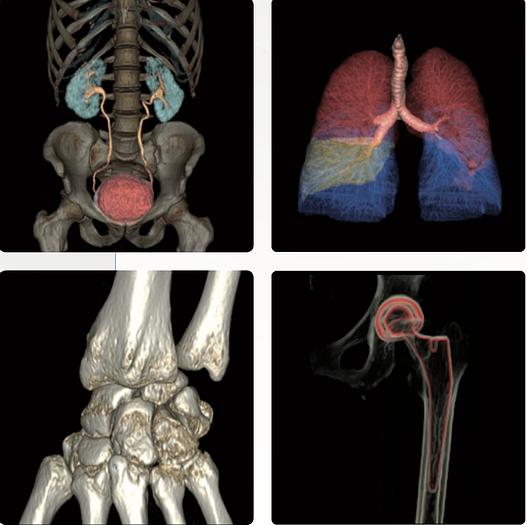 Refurbished 2008 General Electric (GE) LightSpeed VCT
