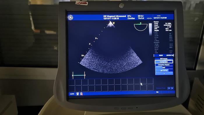 Gebraucht GE 6Tc TEE Ultraschallsonde