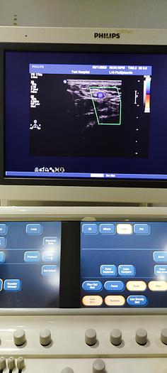 Gebraucht Philips L15-7io Linear Ultraschallsonde