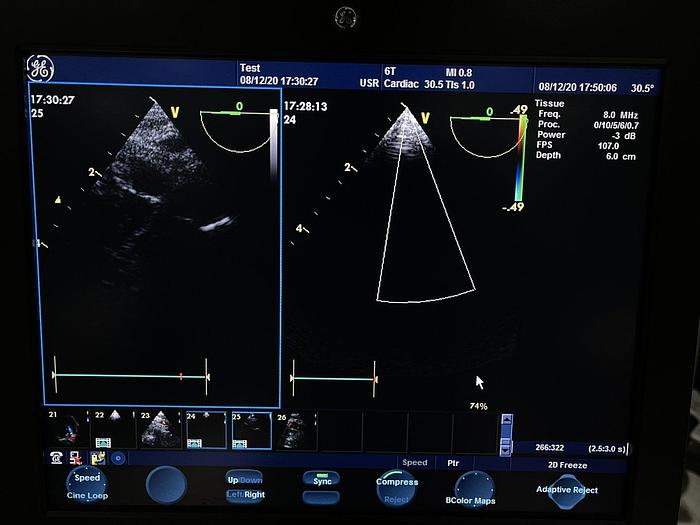 Gebraucht GE 6T Transösophageale Ultraschallsonde TEE Schlucksonde