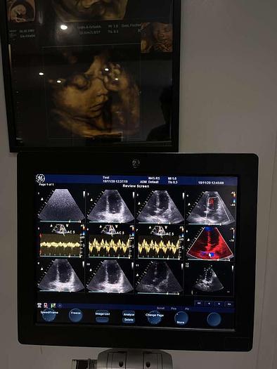 Gebraucht GE Vivid S6 Ultraschallsystem mit Sony Drucker und 1x Sonde