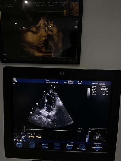 Gebraucht GE Vivid S6 Ultraschallsystem mit Sony Drucker und 1x Sonde