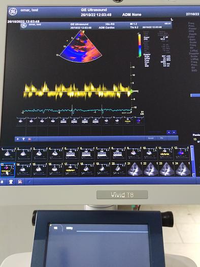 Gebraucht GE Vivid T8