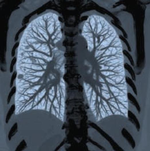 Reformado GE LightSpeed VCT