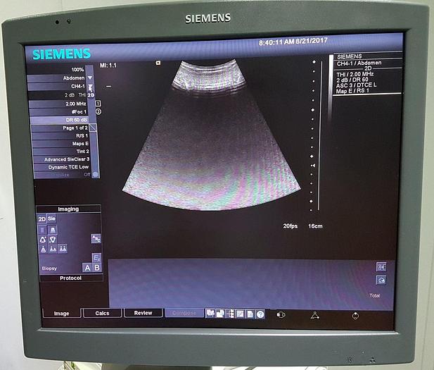 Gebraucht Siemens Acuson Antares Premium Edition 10032746 Ultraschallgerät Flachbildmonitor 5 Sonden Drucker