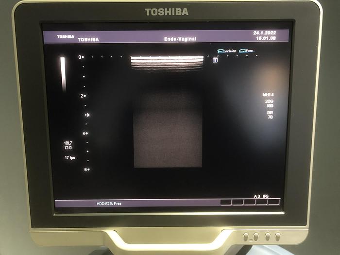 Gebraucht TOSHIPA-Xario-Ultraschallgerät-5046