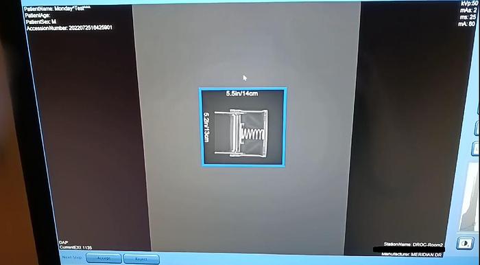 Used Toshiba FDX3543RPW 14x17 Flat Panel Detector