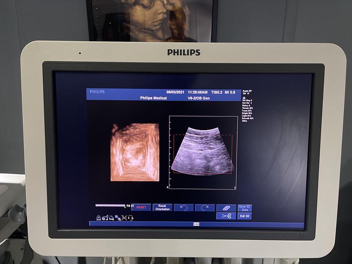 Gebraucht Philips iU22 Ultraschallgerät mit Flachmonitor, 5 Sonden, Sony Drucker, Fußschalter