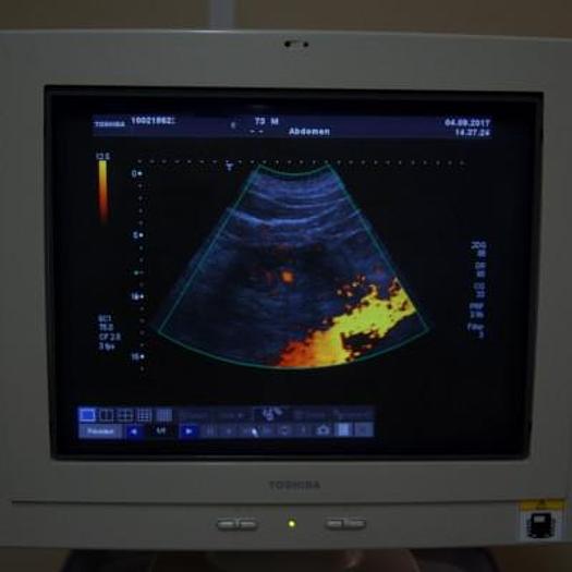 D'occasion ECHOGRAPHE TOSHIBA APLIO COULEUR DOPPLER AVEC 3 SONDES