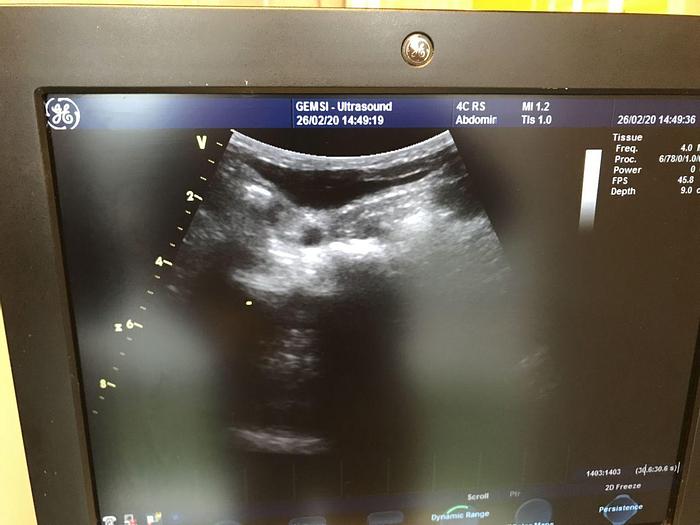 Used For Sale GE 4C-RS OB / GYN - Vascular Ultrasound