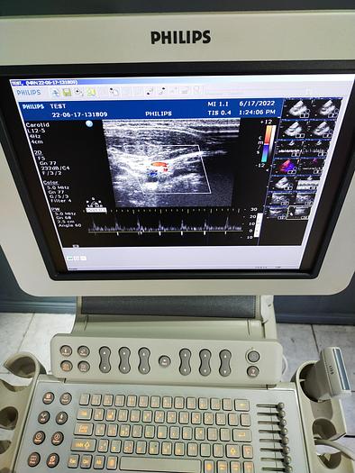 Gebraucht HD 11xe 2197 Ultraschallgerät mit 3 Sonden