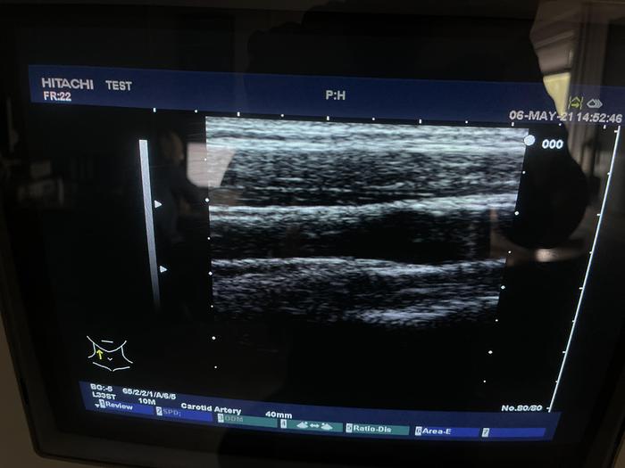 Gebraucht Hitachi EUB-6500