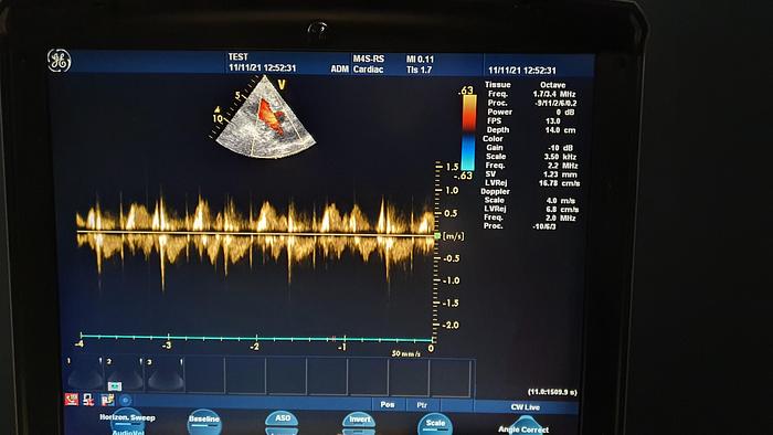 Gebraucht GE Vivid Q Ultraschallgerät