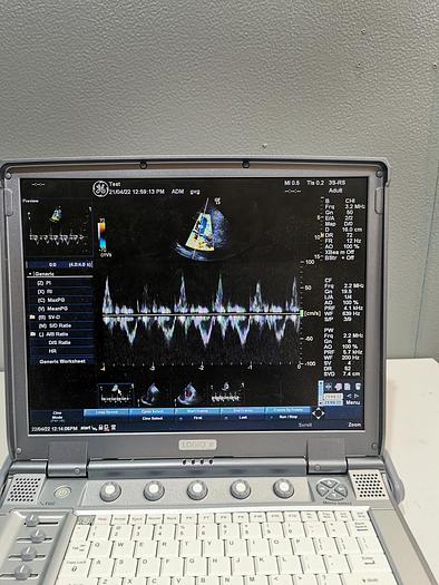 Gebraucht GE LOGIQ e  Tragbare Ultraschallgerät im Koffer mit zwei Sonden
