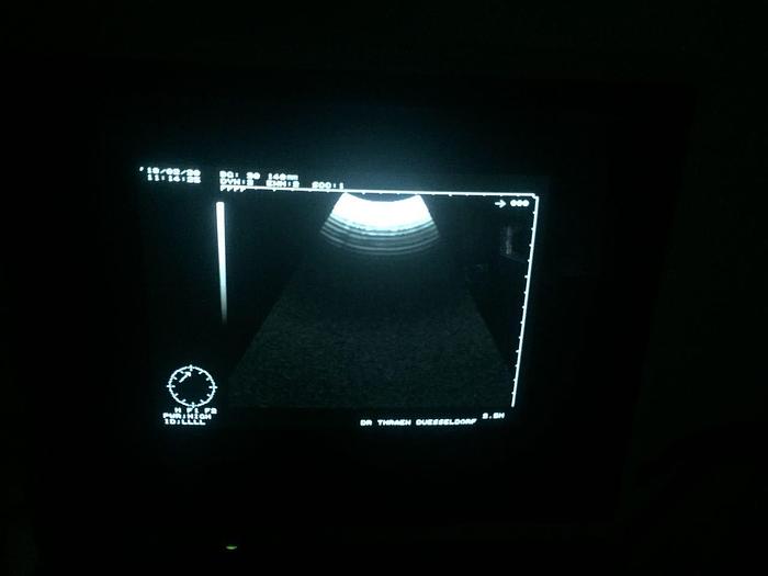 Gebraucht Hitachi LSC 7500 Ultraschallgerät