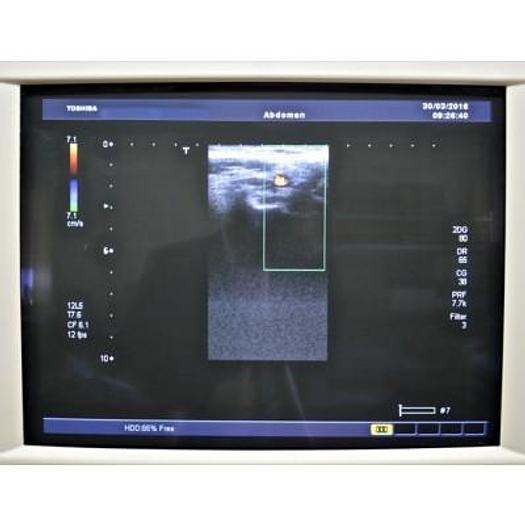 Used TOSHIBA APLIO 80 XARIO AVEC 4 SONDES