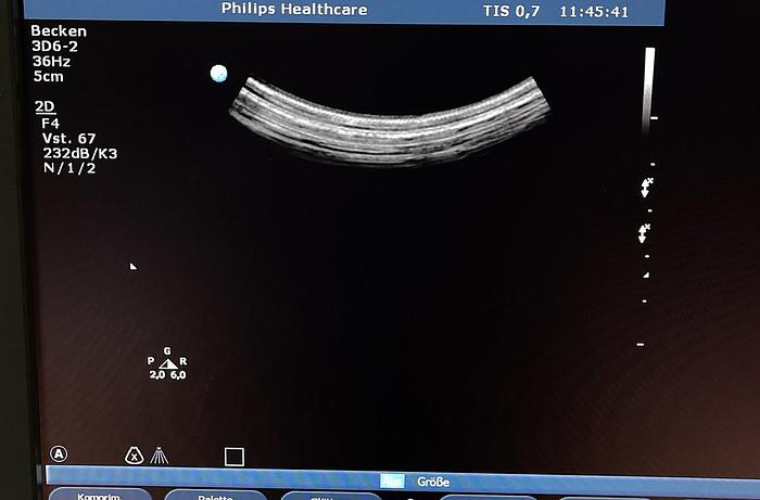 Used Philips Ultraschallsonde Volumen 3D6-2