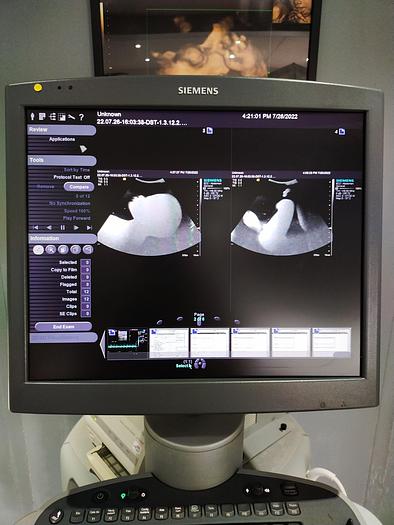 Gebraucht Siemens Acuson S2000 Ultraschallgerät mit Sonde, Farbdrucker und DVD Brenner