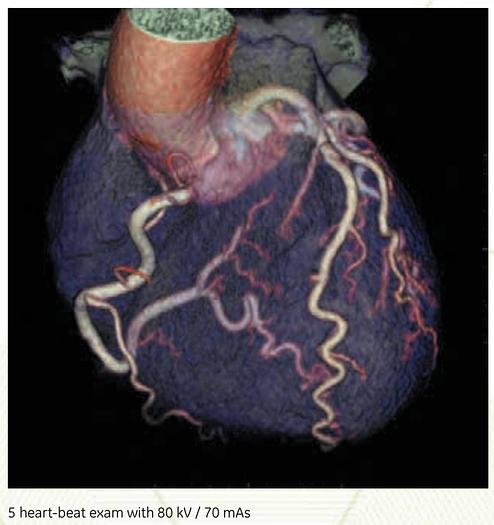 Used 2018 General Electric (GE) Optima CT660