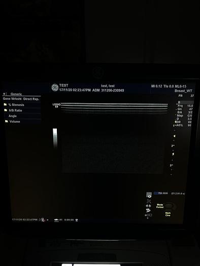 Used GE LOGIQ E9 Ultraschalgerät mit Drucker und 3 Sonden