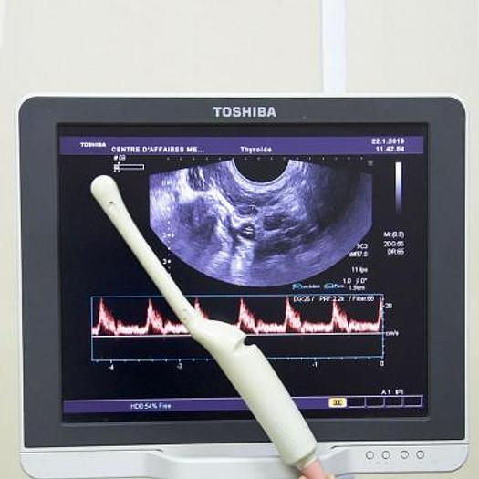 D'occasion ECHOGRAPHE TOSHIBA XARIO COULEUR DOPPLER AVEC 3 SONDES ET ÉCRAN PLAT