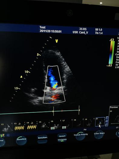 Used GE Ultraschallsonde Kardio / Sektor 3S-RS