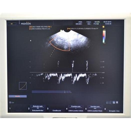 Gebraucht ECHOGRAPHE 3D 4D SAMSUNG MEDISON SONOACE X8 avec 3 sondes