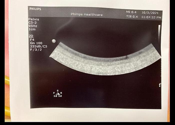 Gebraucht  C5-2 philips ultrasound probe 033MZ4
