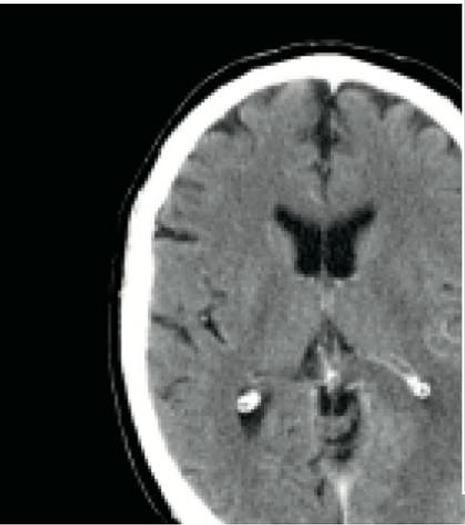 Reformado 2005 General Electric (GE) LightSpeed VCT