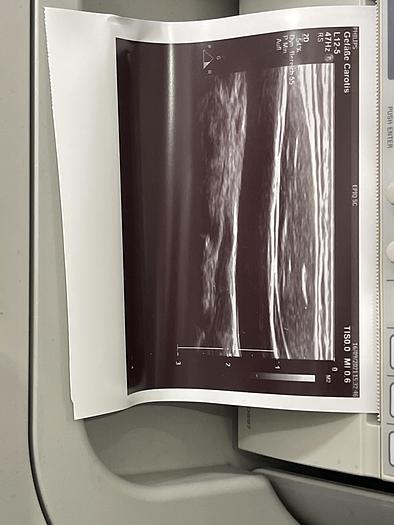 Gebraucht Philips EPIQ 5C Ultraschallsystem mit Sony Drucker