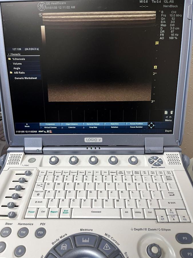 Used GE Logiq E Ultrasound