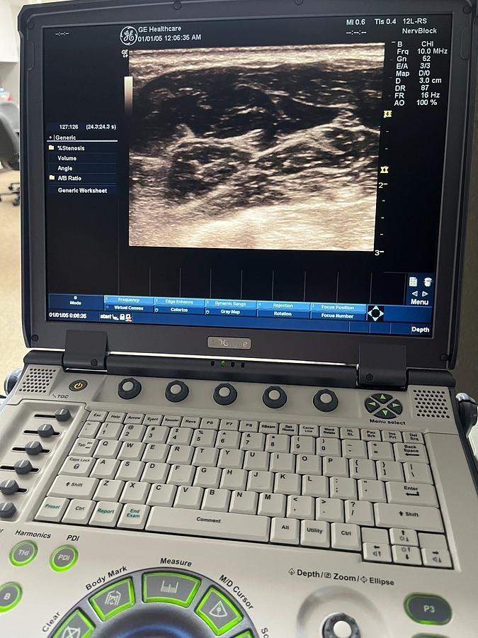 Used GE Logiq E Ultrasound