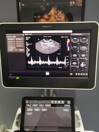 Gebraucht philips, 0110