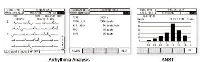 Elektrokardiograph EKG Kenz Cardico 306 ECG