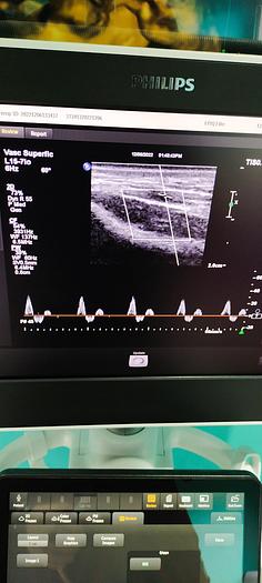 Gebraucht  Philips L15-7io Ultraschallsonde