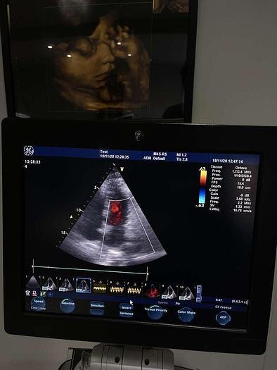 Gebraucht GE Vivid S6 Ultraschallsystem mit Sony Drucker und 1x Sonde