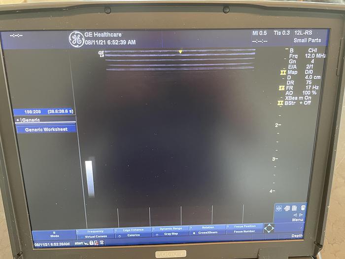 Used 2014 GE Logiq e