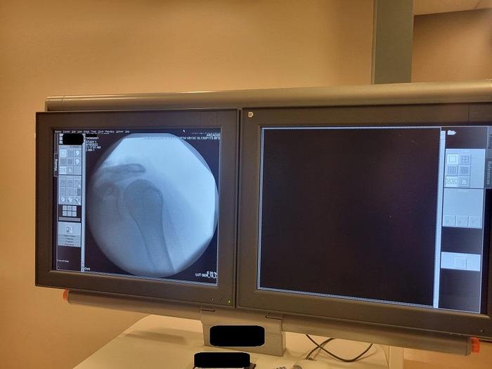 Used Siemens Arcadis Varic