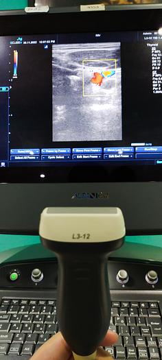 Gebraucht Alpinion E cube 9 Ultraschallgerät SW 2.6 mit 2 Sonde