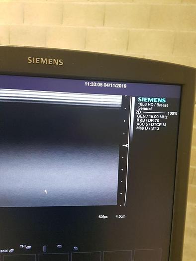 Used SIEMENS S2000 OB / GYN - Vascular Ultrasound