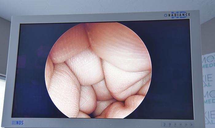 Used NDS 32" Endoscopy HD LCD Medical Monitor Radiance Flat Panel SC-WX32-A1511