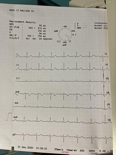 Gebraucht GE Mac1200ST EKG Gerät auf Trolley mit EKG Kabel