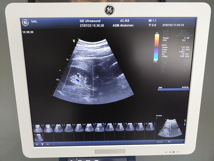 Gebraucht GE Vivid T8 Ultraschallsystem für Herz- und Gefäß-Ultraschall mit Kardio Sonde SW: R1.0.7