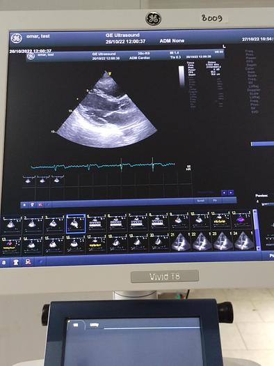 Gebraucht GE Vivid T8 Ultraschallsystem für Herz- und Gefäß-Ultraschall mit Kardio Sonde SW: R1.0.7