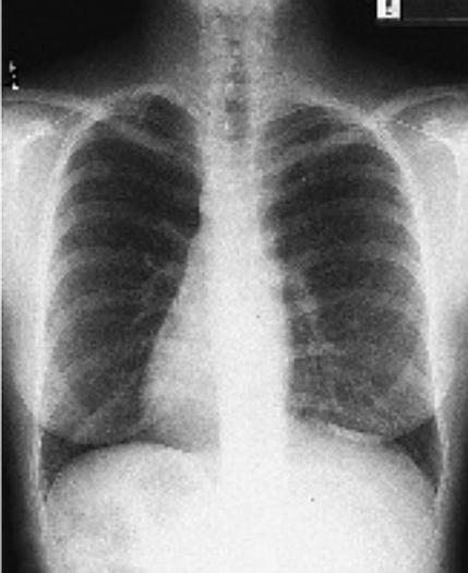 Usado 2001 General Electric (GE) Proteus Xr/a