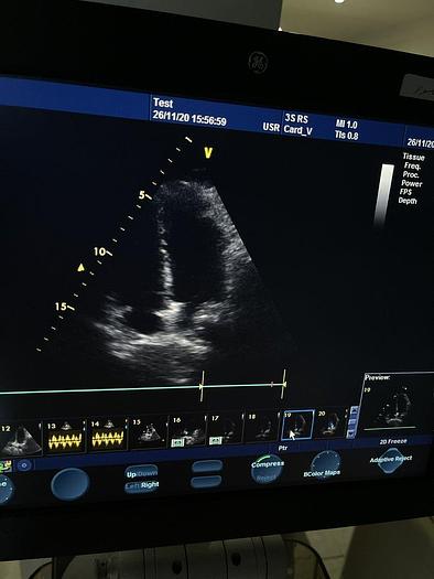 Gebraucht GE Ultraschallsonde Kardio / Sektor 3S-RS