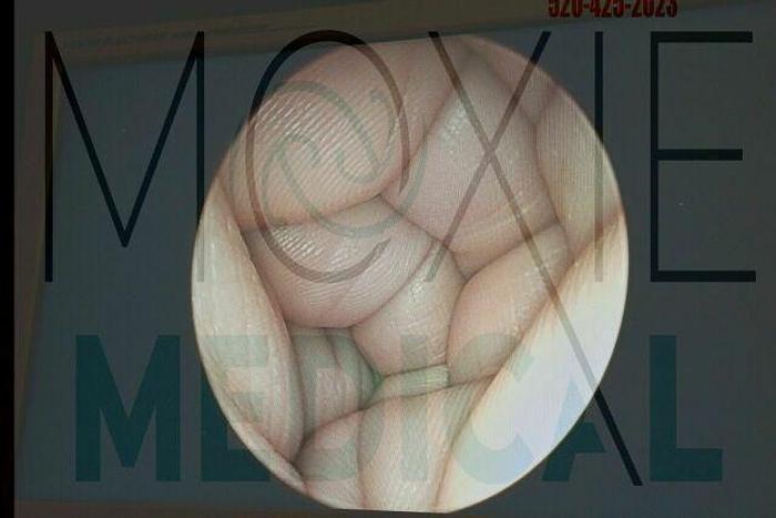 Refurbished Conmed Linvatec 2.9 mm 30° Autoclavable Arthroscope, Eyepiece, T-Latch, 152 mm, Reference T2930