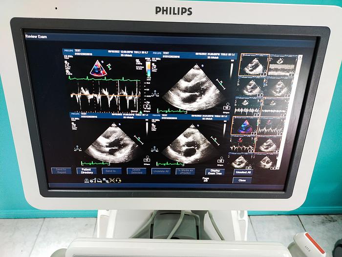 Gebraucht Philips IE33