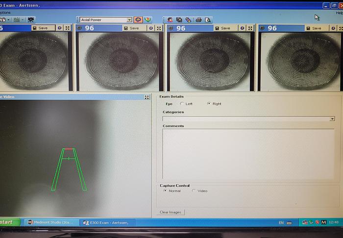 Refurbished 2007 Medmont E300
