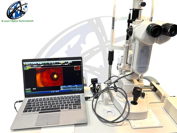 Refurbished Topcon IS-600 with Dc-4 camera